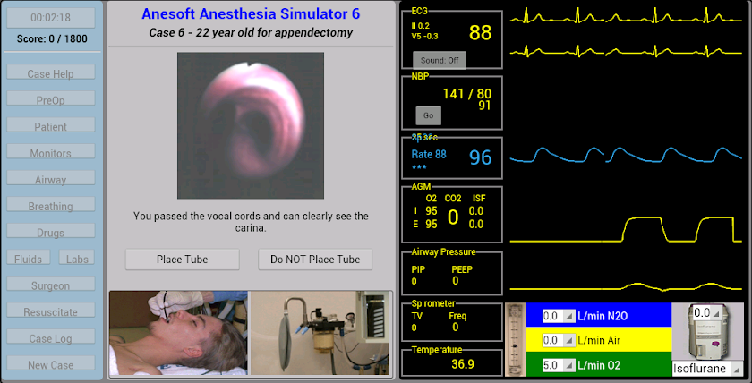 Anesthesia Sim 6 Screen 3