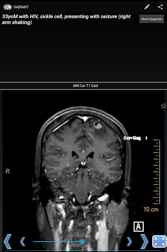 RADIANT: Share Radiology Cases