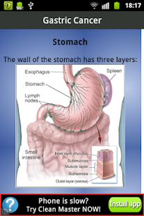 Free Gastric Cancer APK