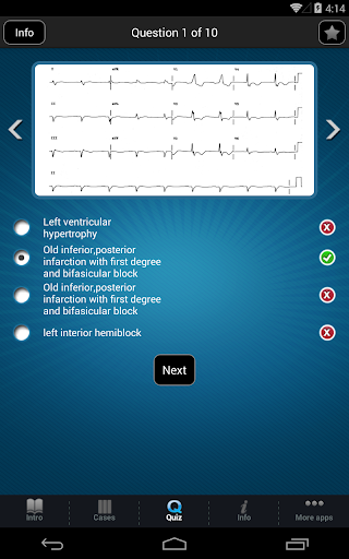 【免費醫療App】ECG - Electrocardiogram Review-APP點子