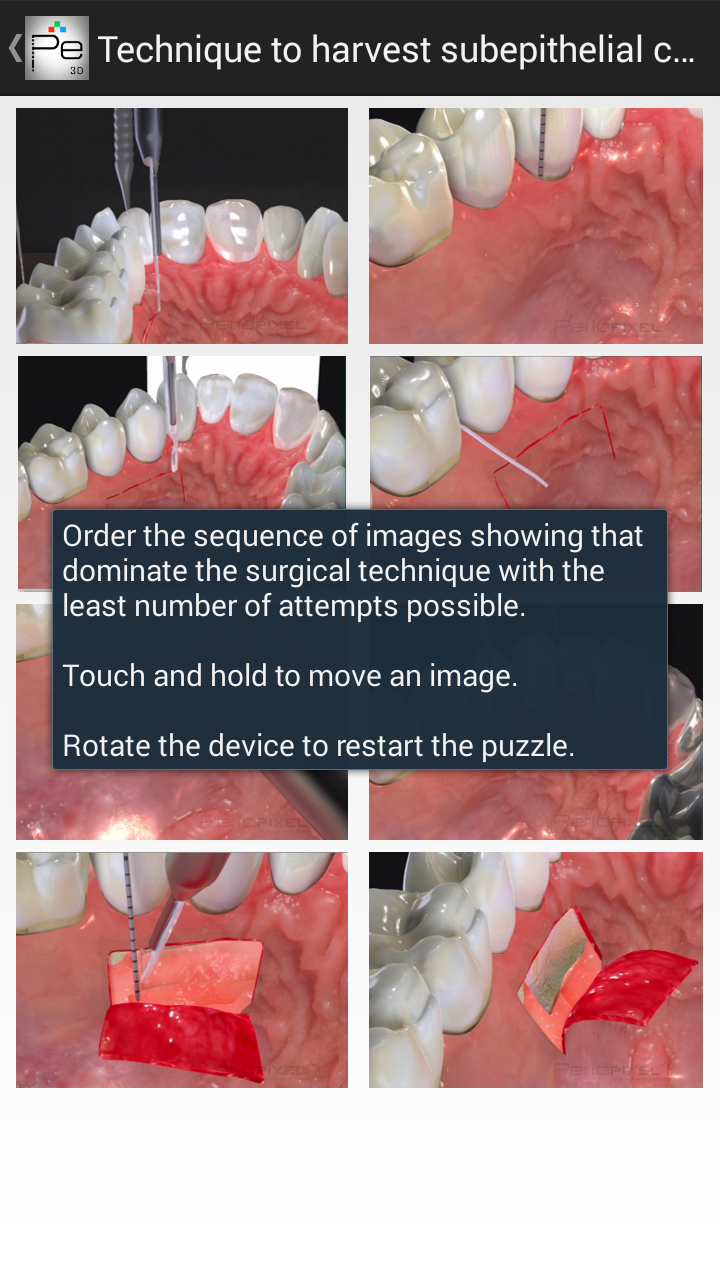 Periodontal Advanced Surgery Screen 3
