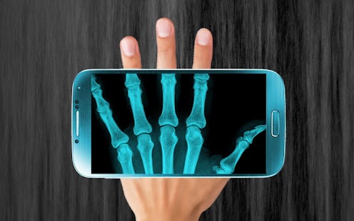 How to get Xray Hand Scanner Prank 1.0 apk for laptop