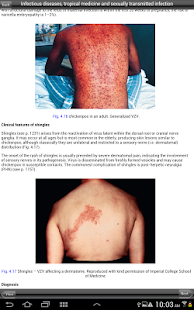 Lastest Clinical medicine APK for PC