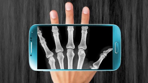 Android application X-Ray Scanner screenshort
