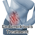 Endometriosis Treatment1.0