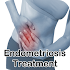 Endometriosis Treatment1.0