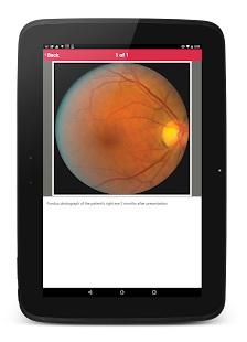 The JAMA Network Challenge Screenshots 1