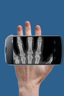 How to mod Xray Scan Prank 1.7 apk for android