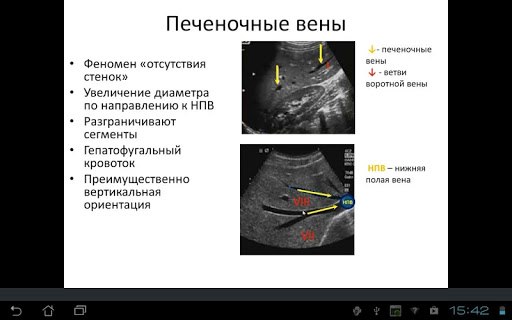 【免費醫療App】Основы УЗ анатомии печени-APP點子