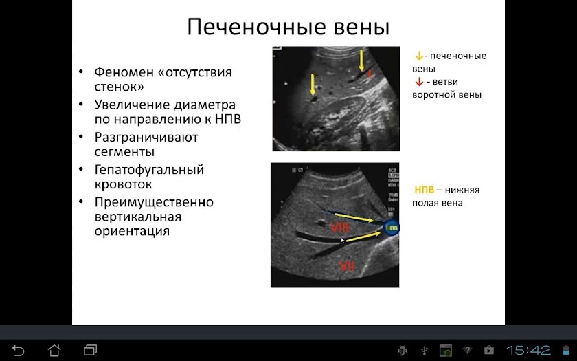 Основы УЗ анатомии печени Screen 2