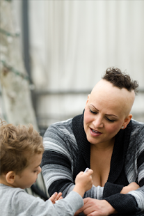 Alopecia Symptoms FREE Screenshots 0