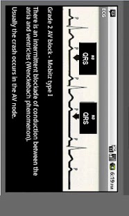 免費下載醫療APP|Electrocardiogram ECG Types app開箱文|APP開箱王